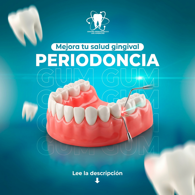 Periodoncia